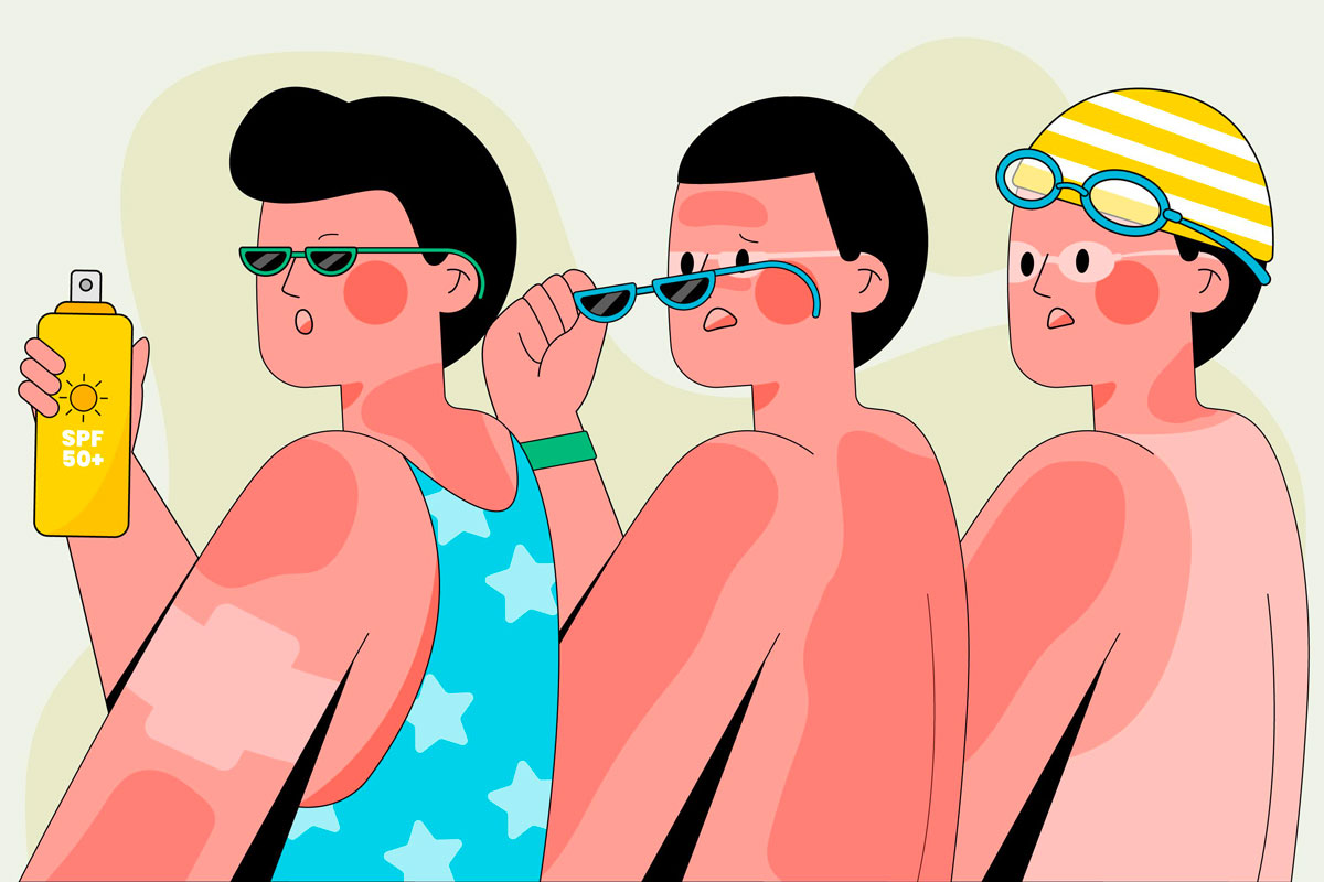 Image differentes personnes coup soleil
